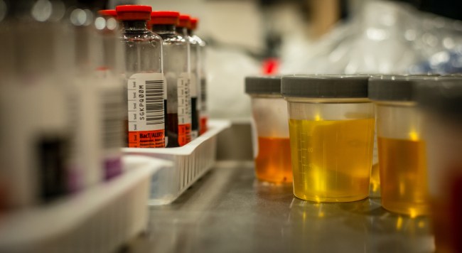 Can you pass drug test with animal urine