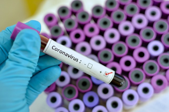 New study suggests that Coronavirus could lead to 15 million deaths