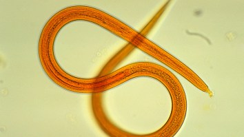 Woman Finds A Live 1.5-Inch Long Worm Living In Her Tonsils After Complaining Of Sore Throat