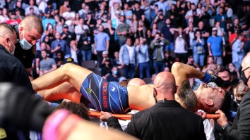 Chris Weidman Shares X-Rays Showing Just How Severly He Snapped His Leg At UFC 261