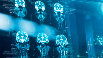 Scientist With No Qualifications Performed Brain Surgery On Himself At Home
