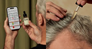 Roots by GA hair loss treatment