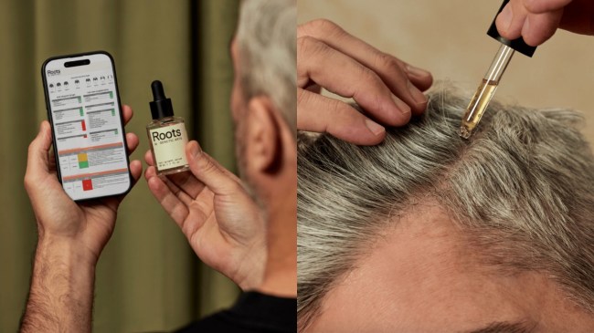 Roots by GA hair loss treatment