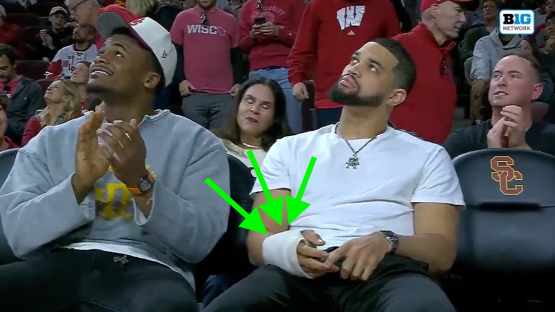 Caleb Williams Cast Wrap Throwing Hand Injury Cyst