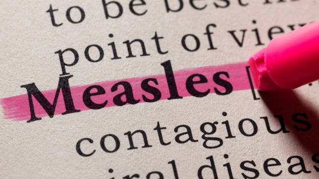 Definition of measles photo