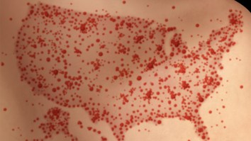 Measles Cases In Texas Surpass 600 As Number Of States Reporting Infections Rises To 29