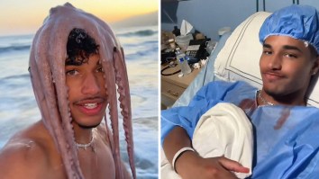 ‘60 Million Views At What Cost’: Man Puts Octopus On His Head For TikTok Video. Then He Ends Up In The Hospital